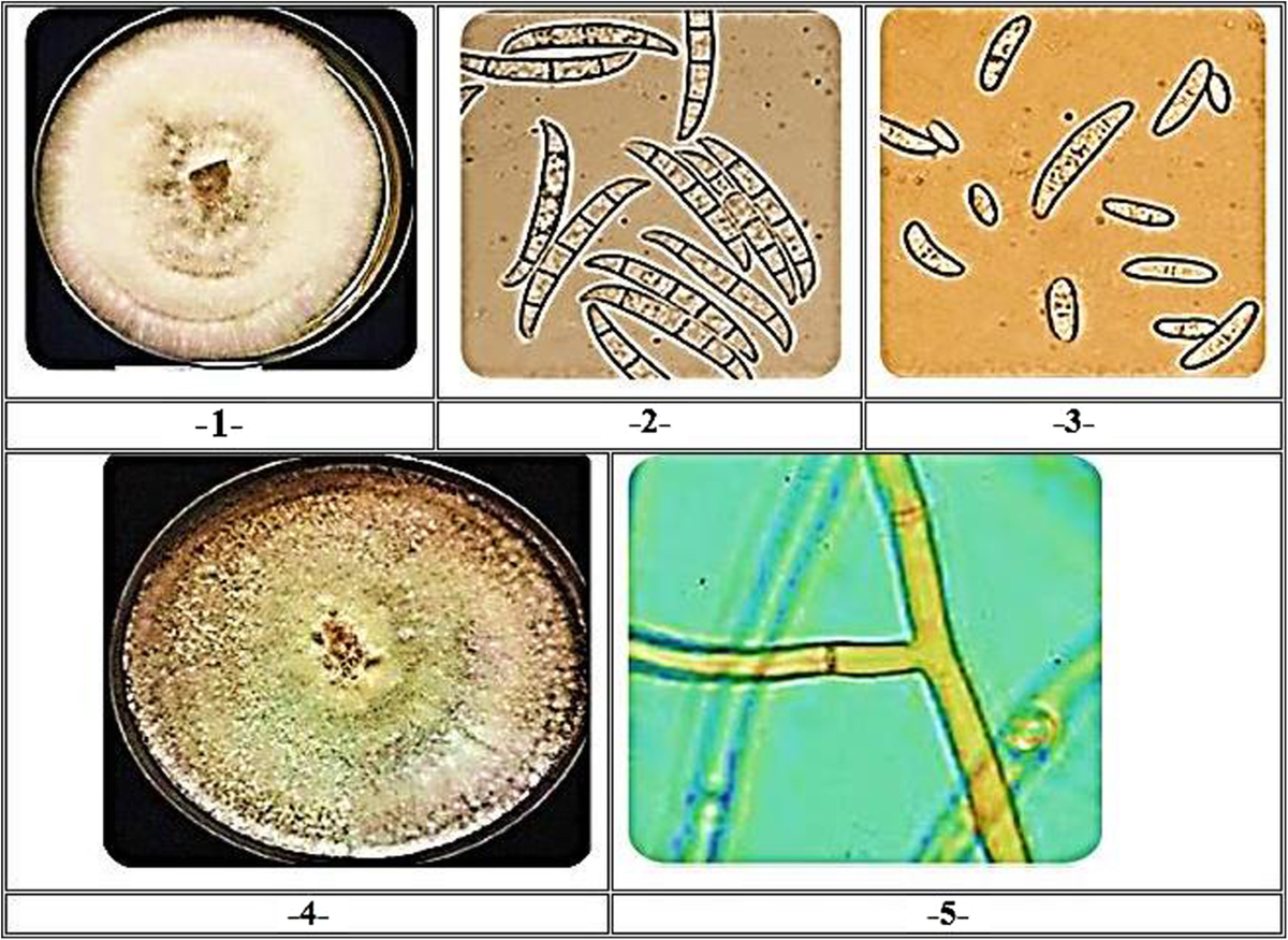 Rhizoctonia solani تحت المجهر