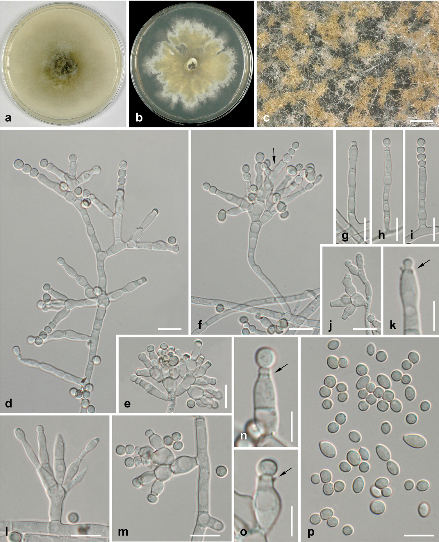 Verticillium dahliae تحت المجهر