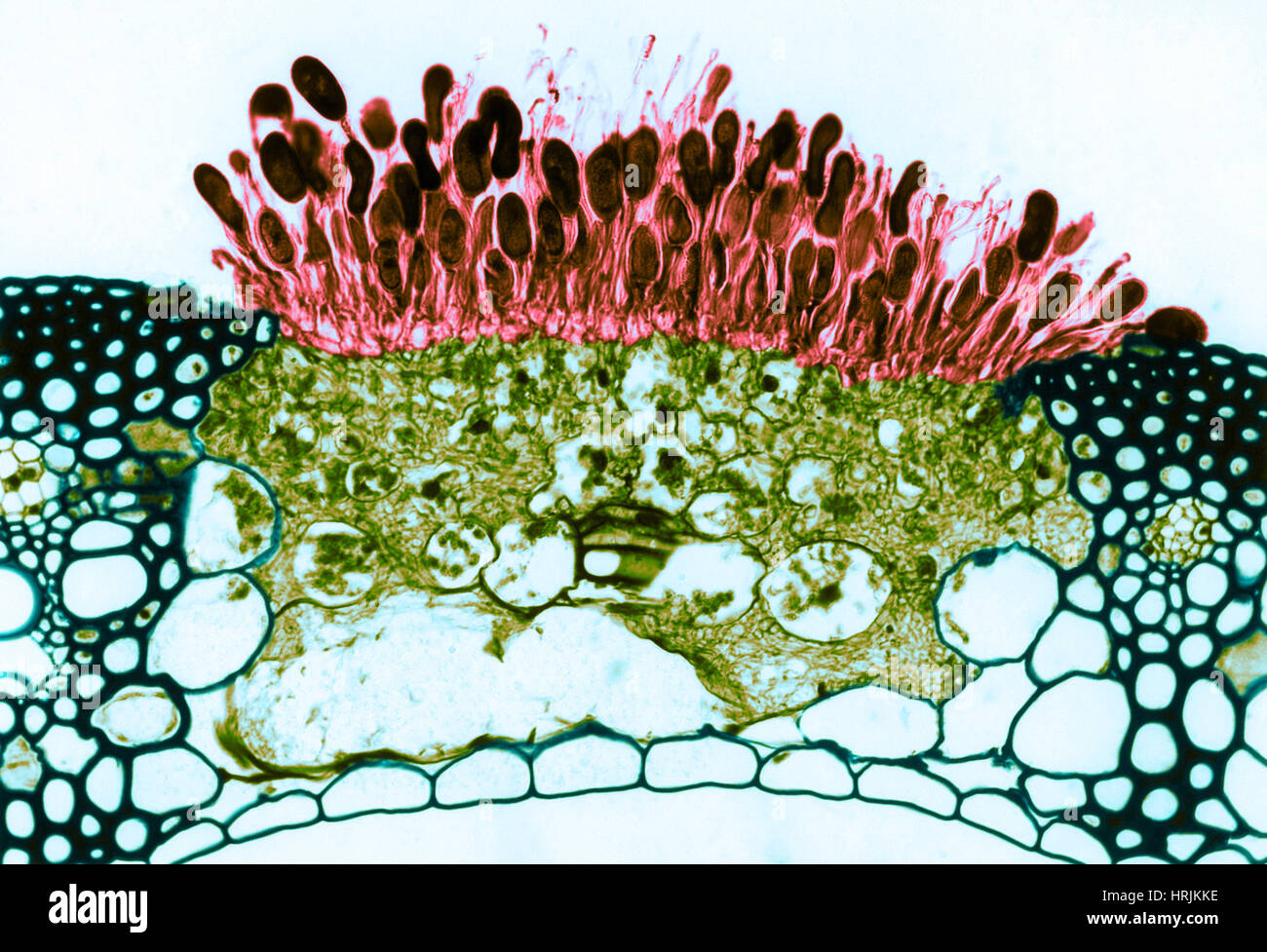 Puccinia graminis تحت المجهر