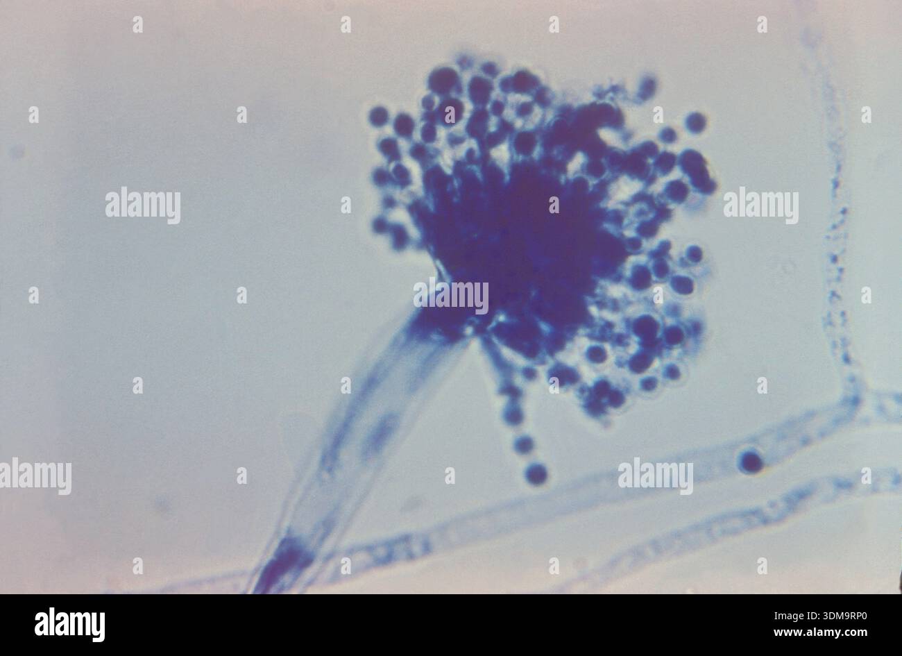 Aspergillus flavus تحت المجهر